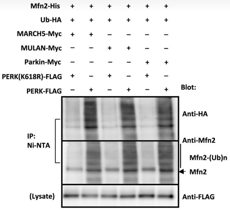 In vitro ubiquitination assay utilizing phosphorylated E3 ligases.