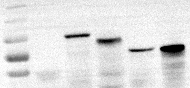 In vitro Protein Expression and Detection.