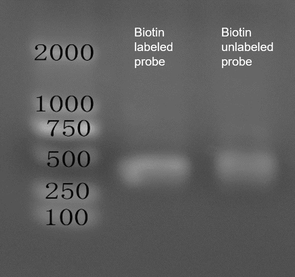 Agarose Gel Electrophoresis.