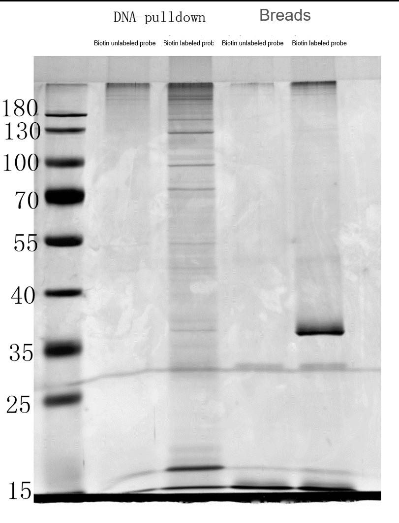 SDS-PAGE for Proteins.