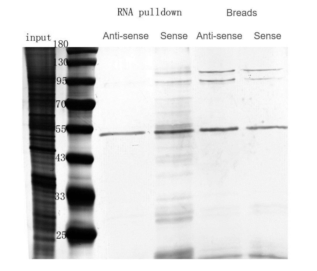 Silver Staining for Proteins.